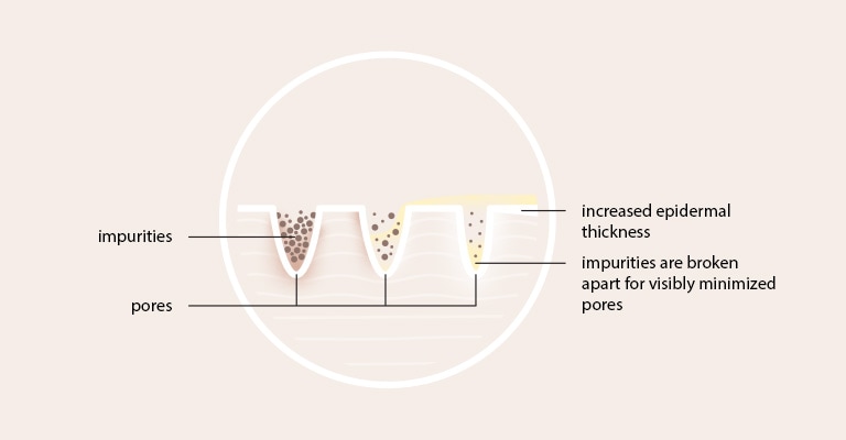 Find out how pore refiner works