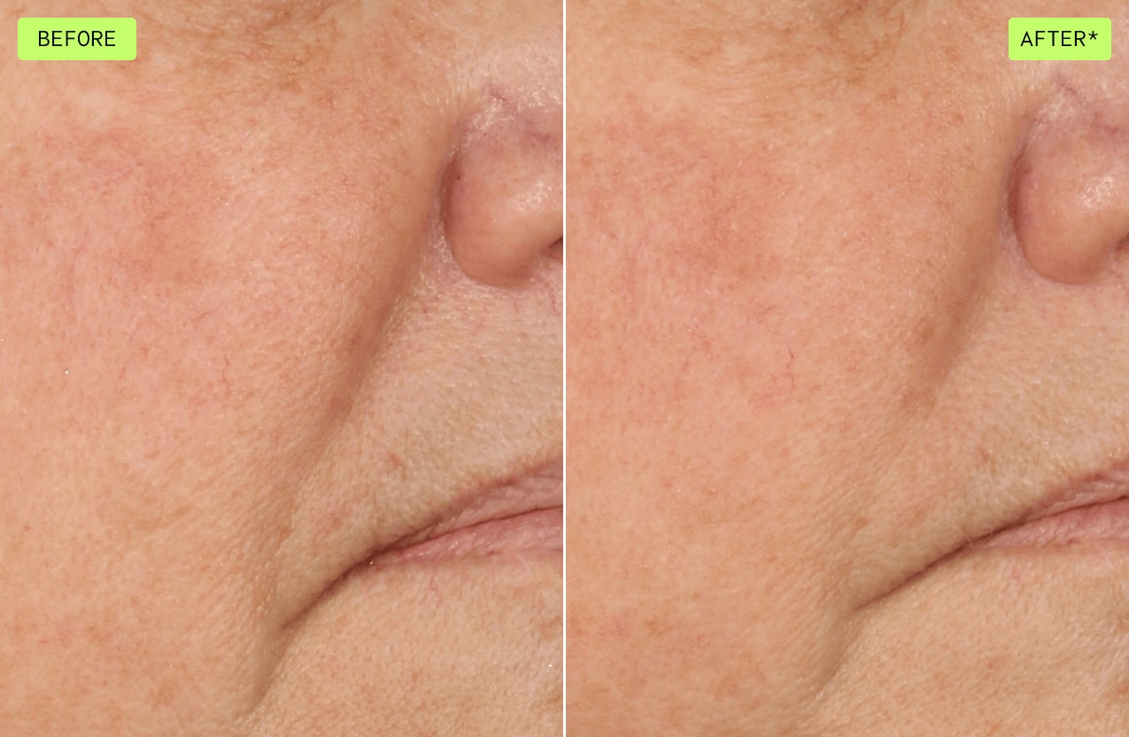 See the difference when using botanical repair