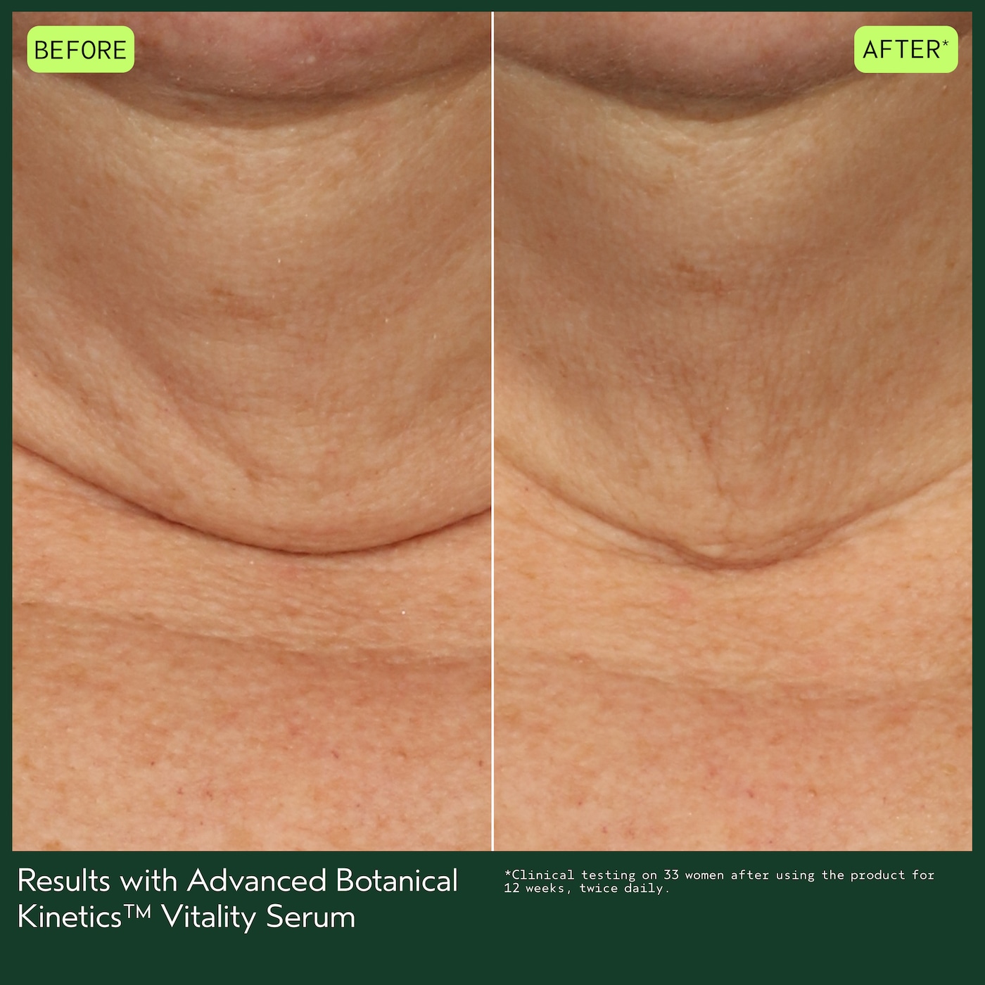 Advanced Botanical Kinetics™ Vitality Serum