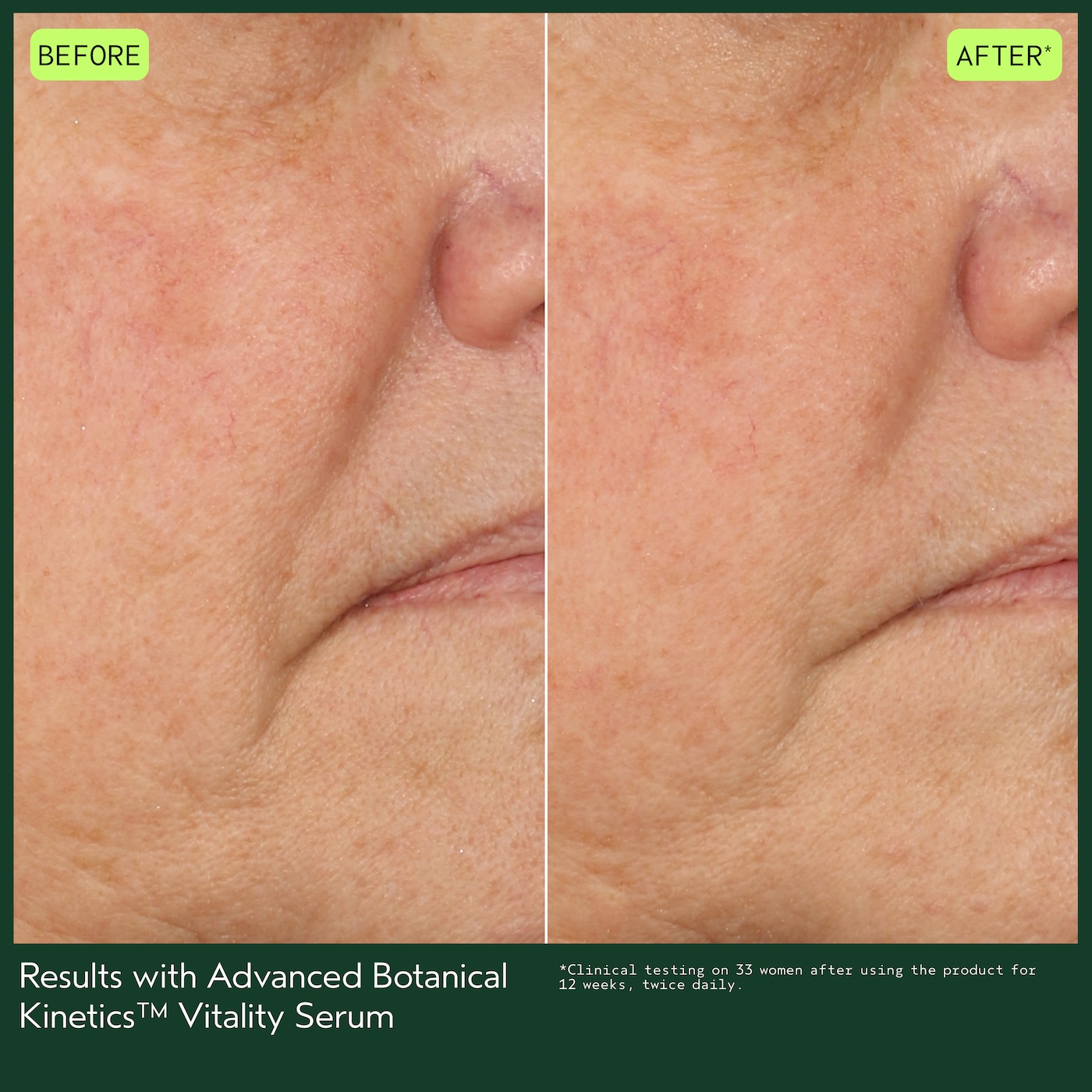 Advanced Botanical Kinetics™ Vitality Serum